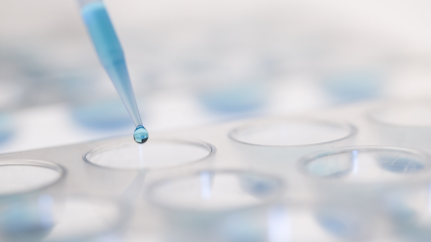 Hereditary Cancer Testing